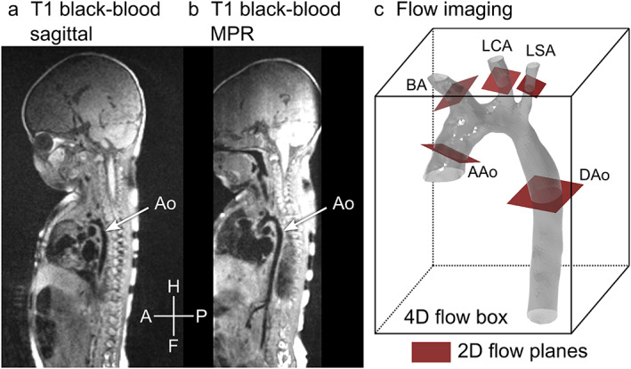 FIGURE 2