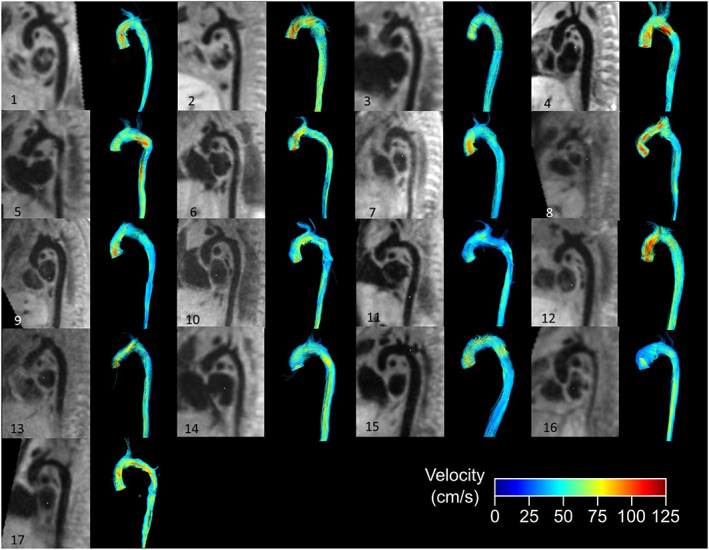 FIGURE 4