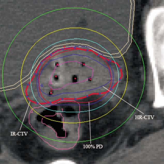 Figure 2.