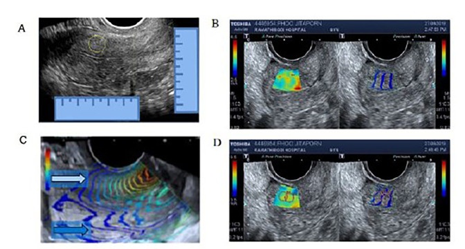 Fig.2