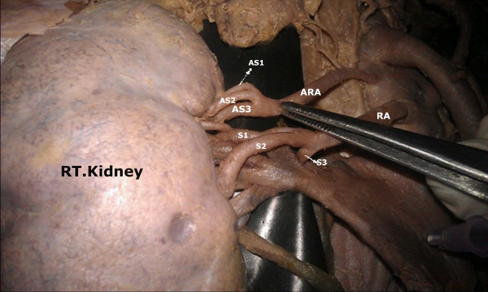 [Table/Fig-4]: