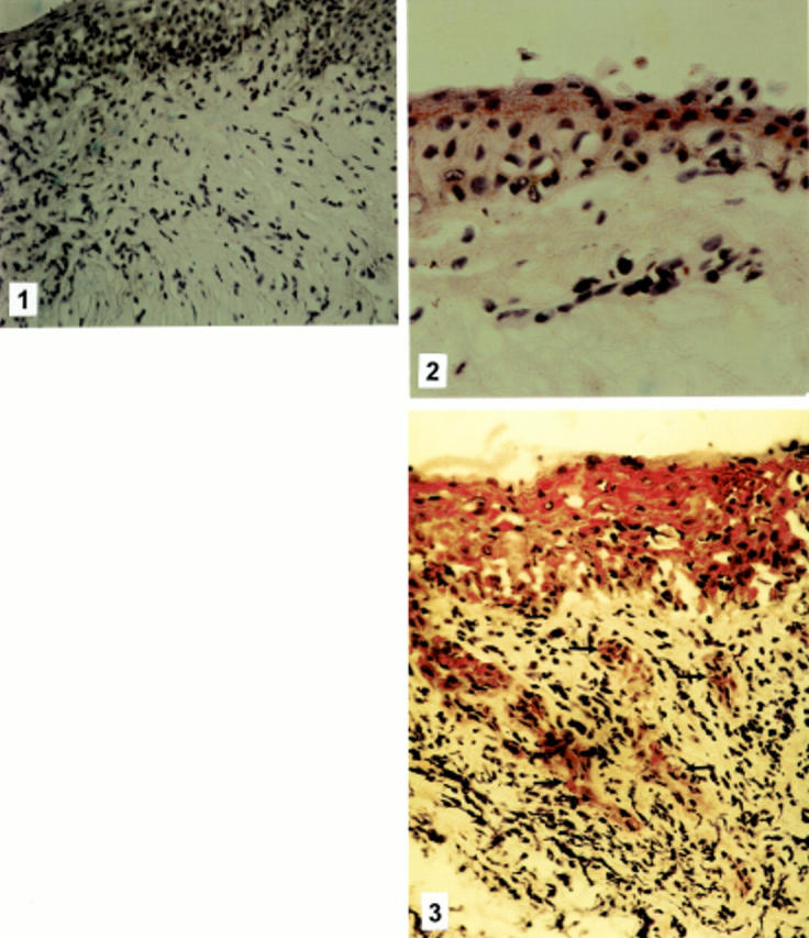 Figure 1  