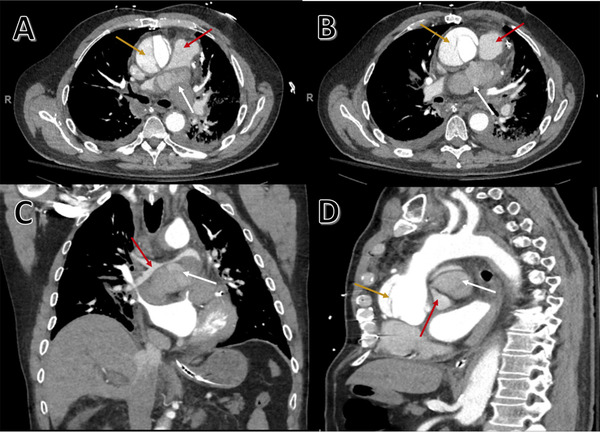 FIGURE 2