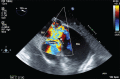 Figure 4)