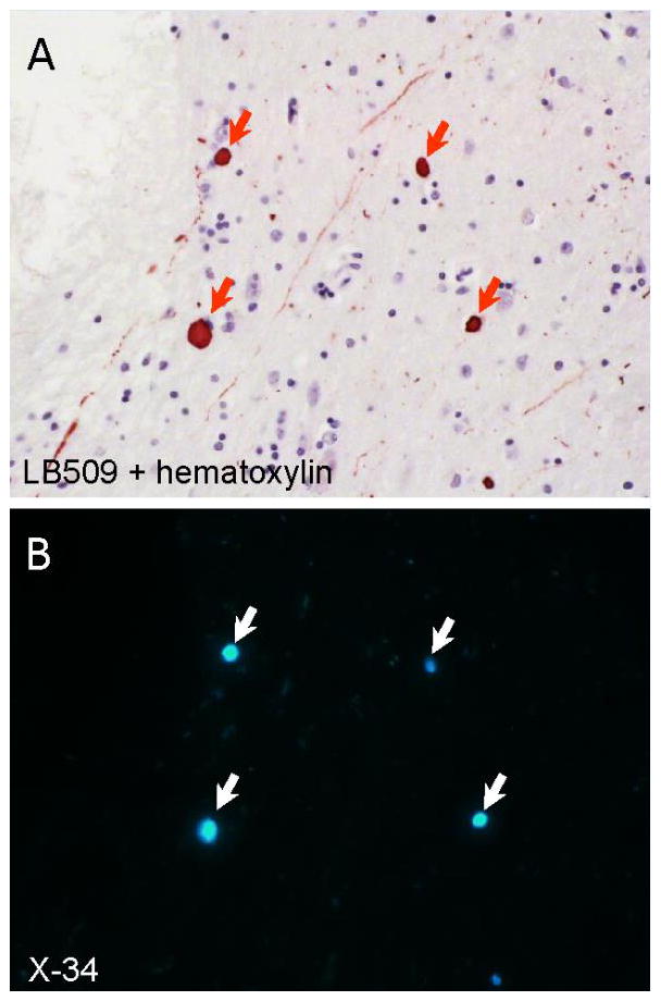 Figure 14