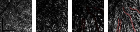 Fig. 10