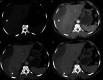 Fig 1: