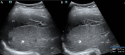 Fig 2: