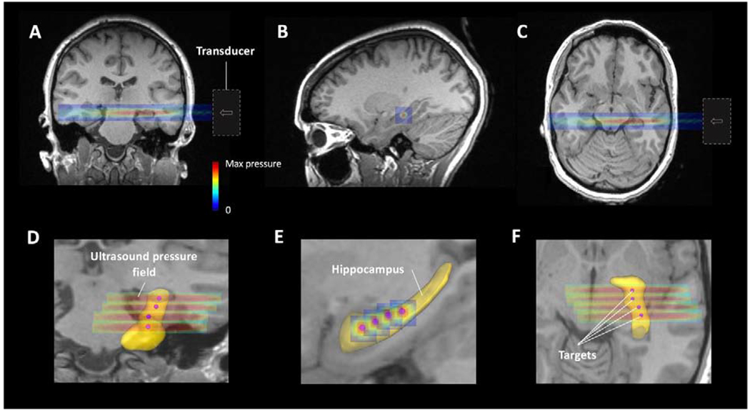 Fig. 2: