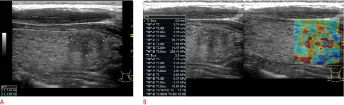 Fig. 13.