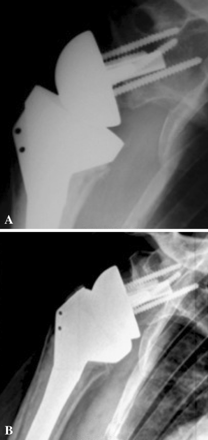 Fig. 5A–B