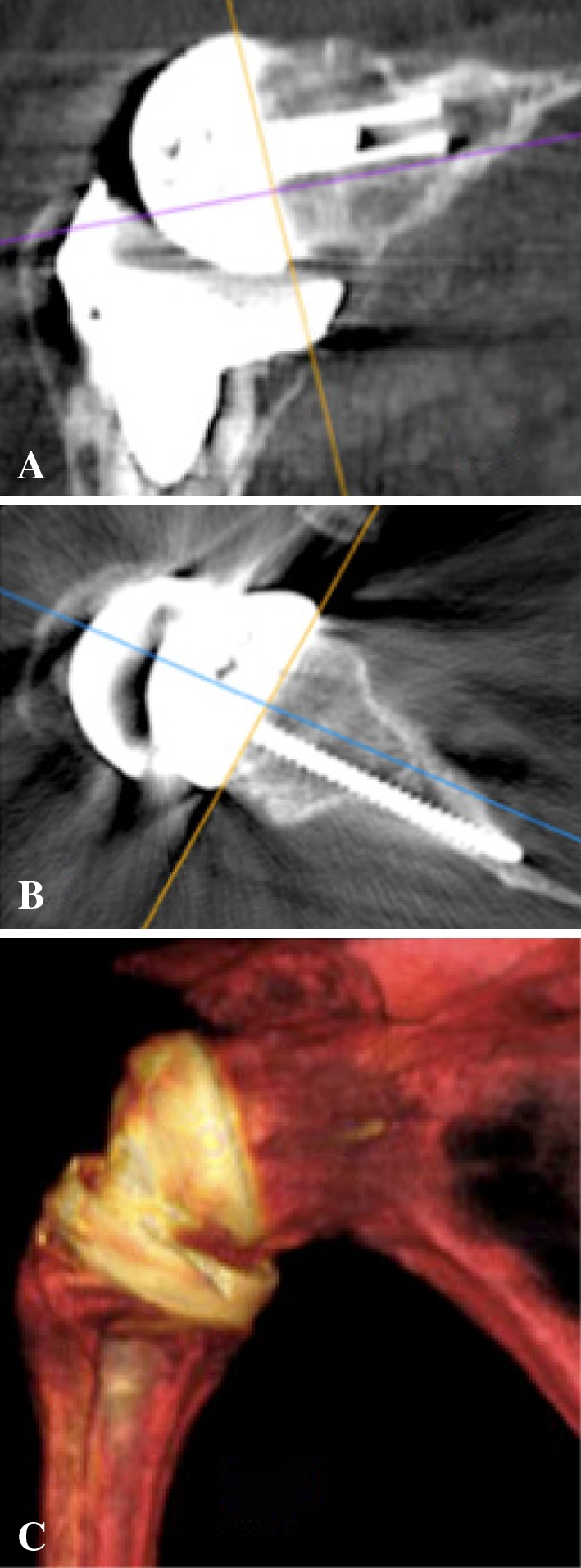 Fig. 6A–C