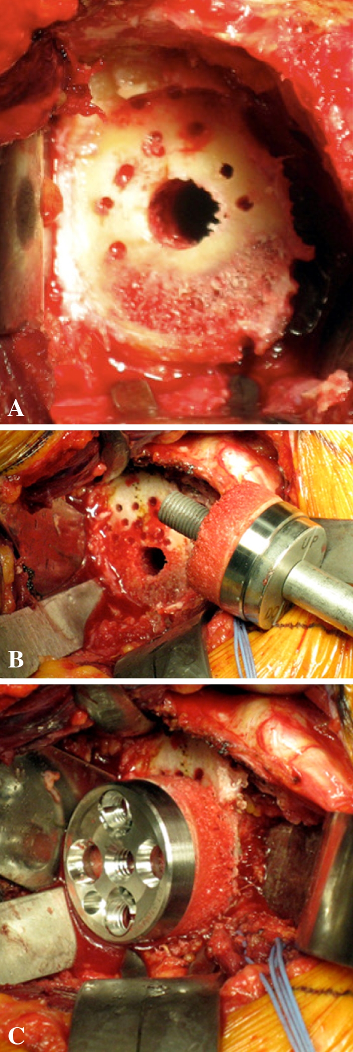 Fig. 4A–C