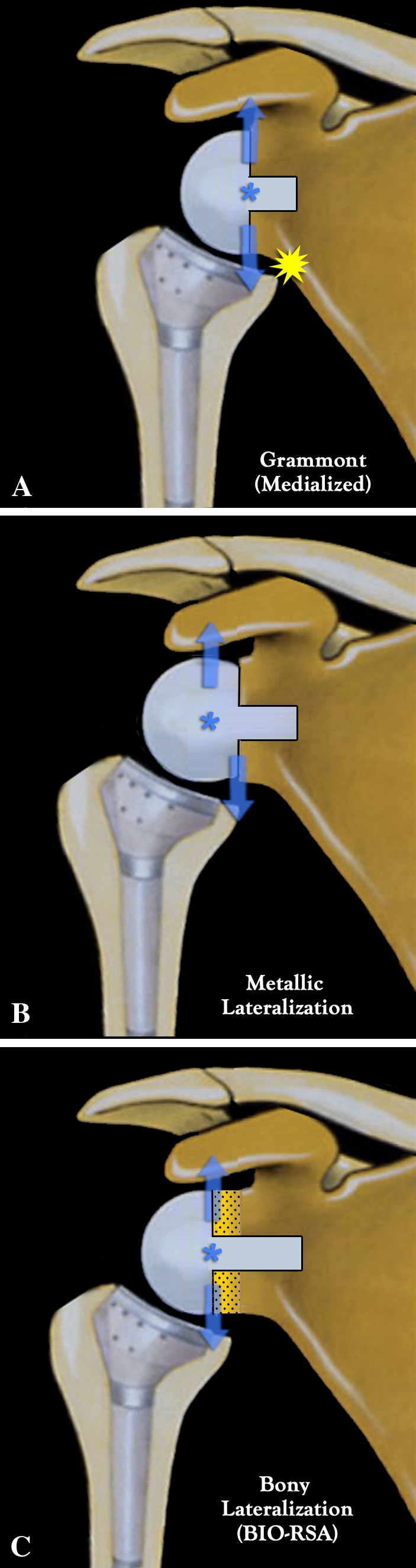 Fig. 1A–C