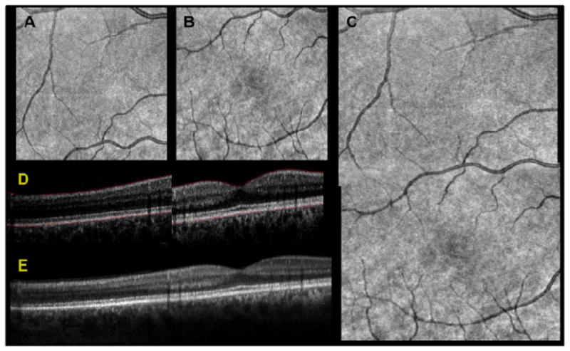 Fig. 3