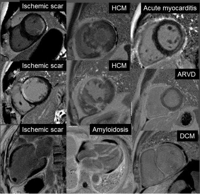 Figure 14