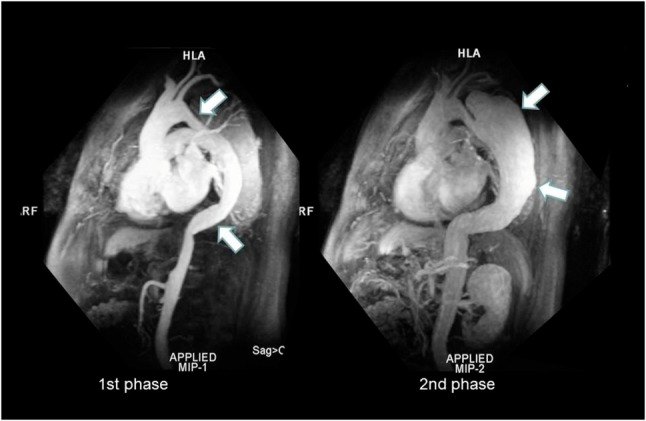 Figure 19