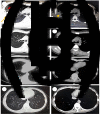 Fig. 1.