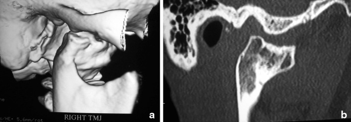 Fig. 6