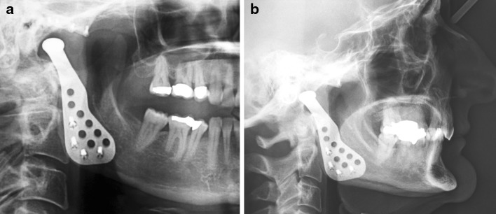 Fig. 3