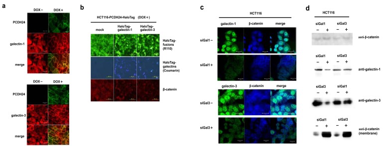 Fig. (3). Effects of galectin-1 and -3 expression on the subcellular localization of β-catenin