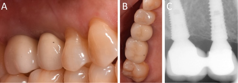 Fig. 17