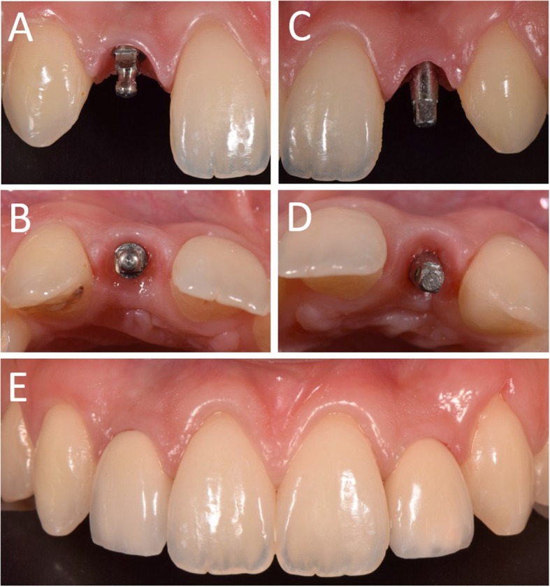 Fig. 11