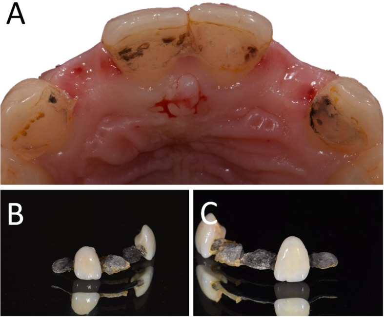 Fig. 2