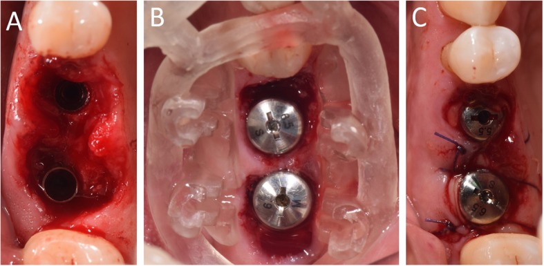 Fig. 14