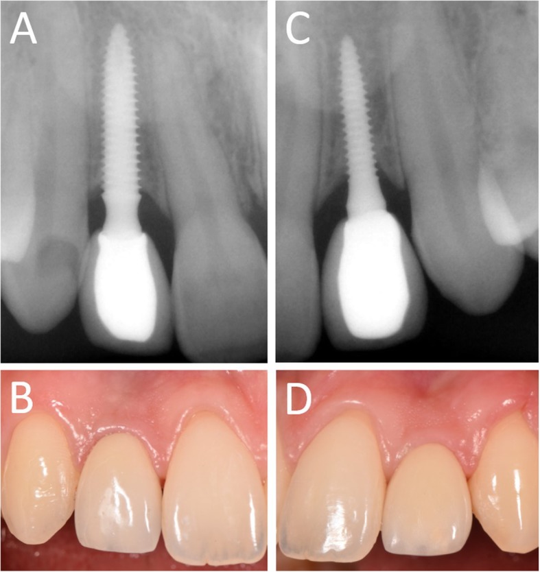 Fig. 12