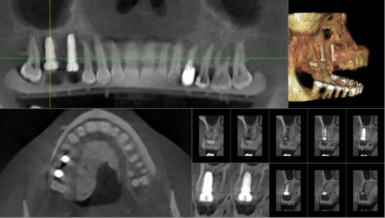 Fig. 15