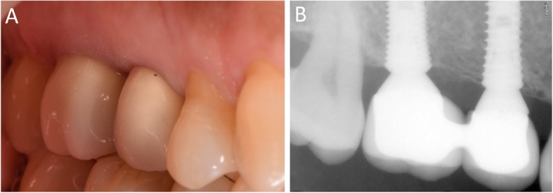 Fig. 16