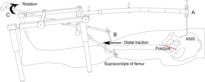 Fig 3