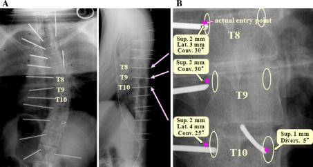 Fig. 1