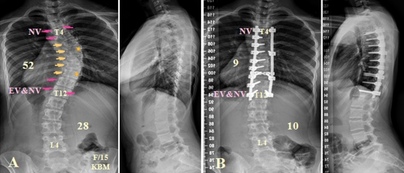 Fig. 2