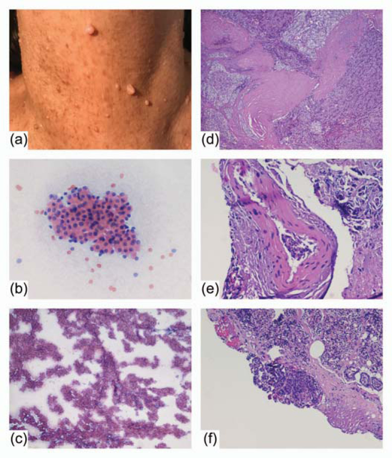 Fig. (2)