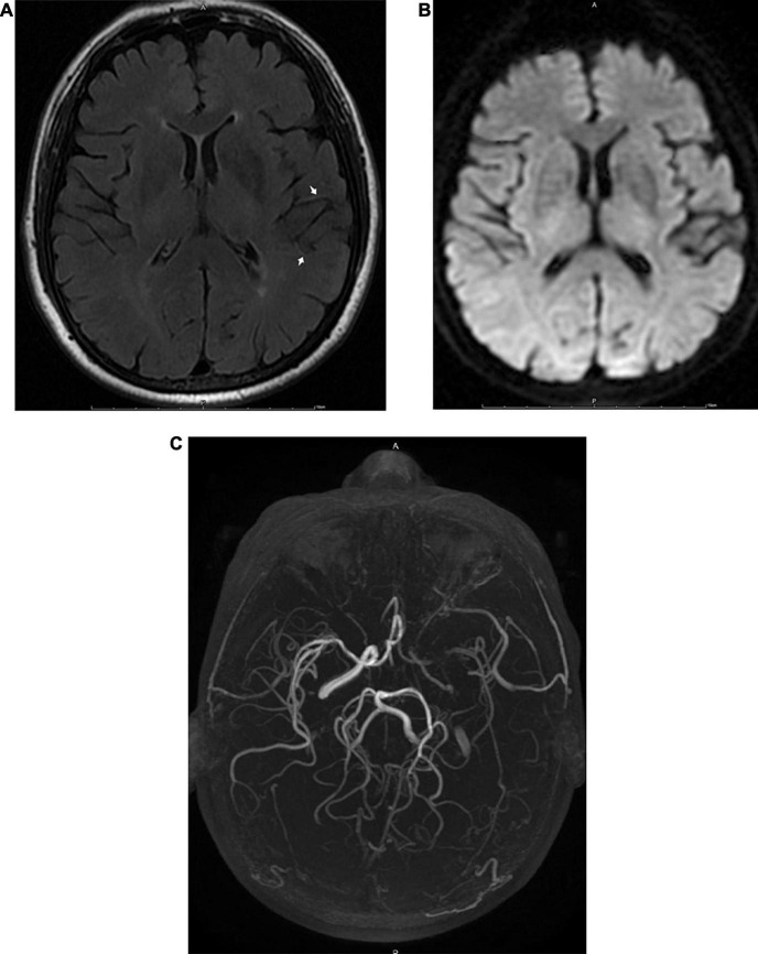 FIGURE 3