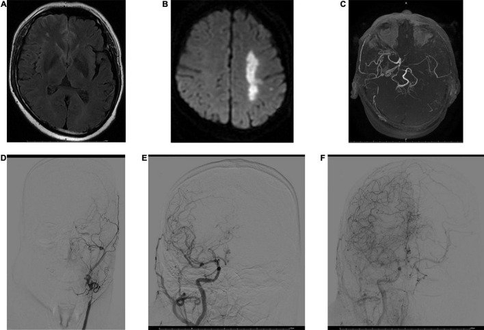 FIGURE 2