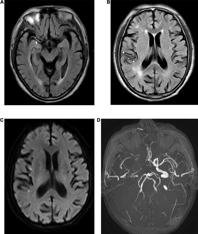 FIGURE 1