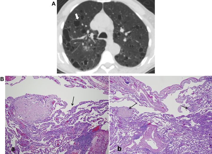 Figure 28