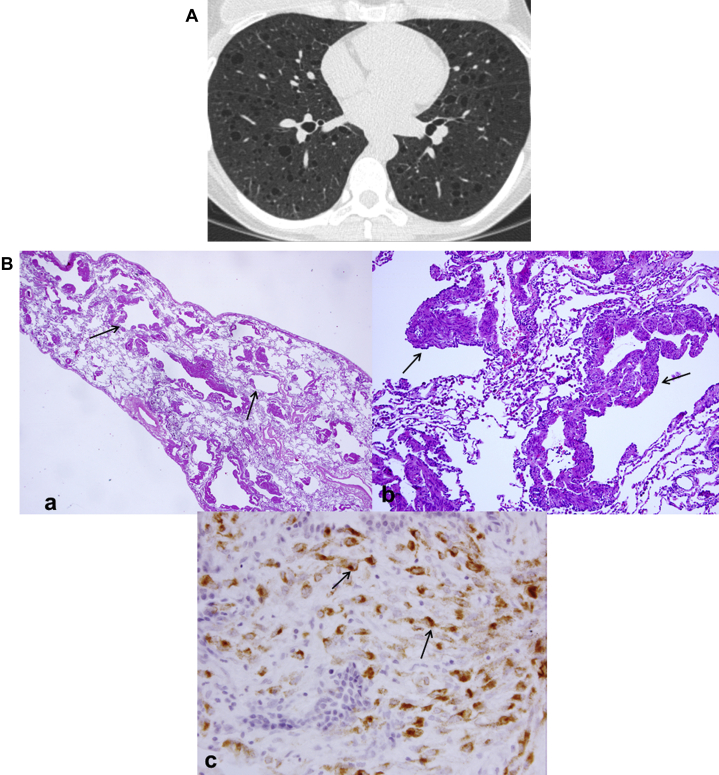 Figure 24