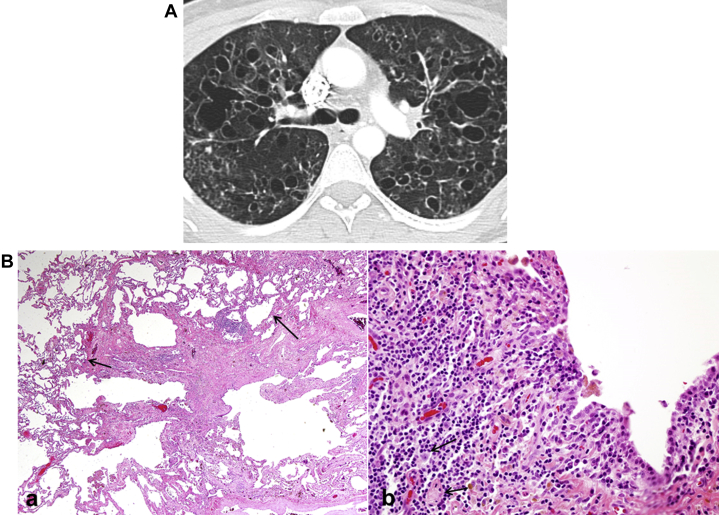 Figure 25