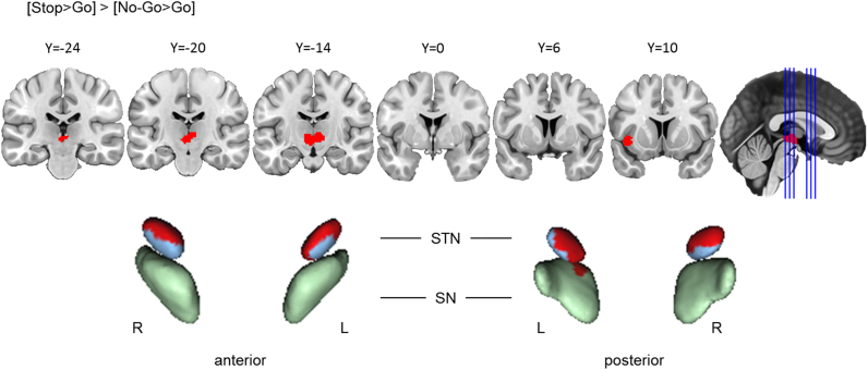 Fig. 3.5