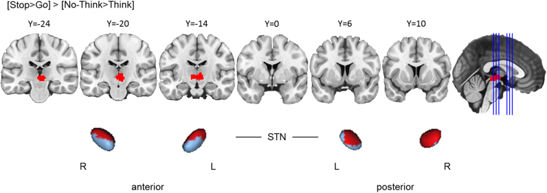 Fig. 3.10