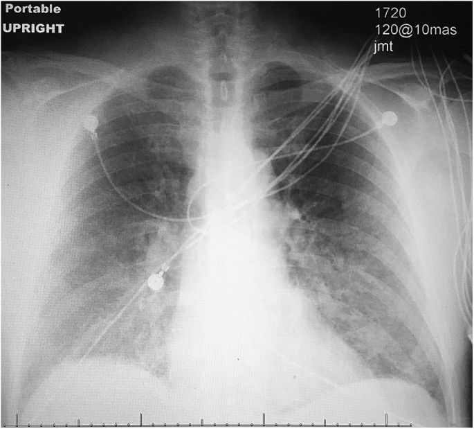 Fig. 1