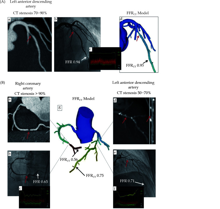 Figure 30