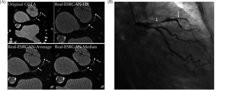 Figure 34