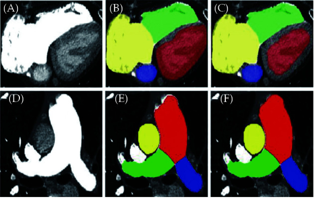 Figure 35