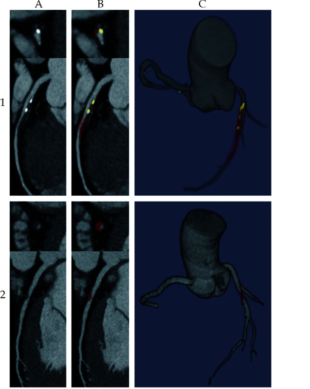 Figure 33