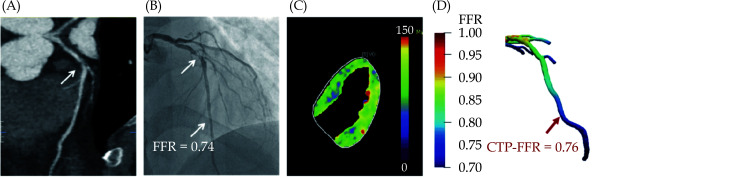 Figure 32